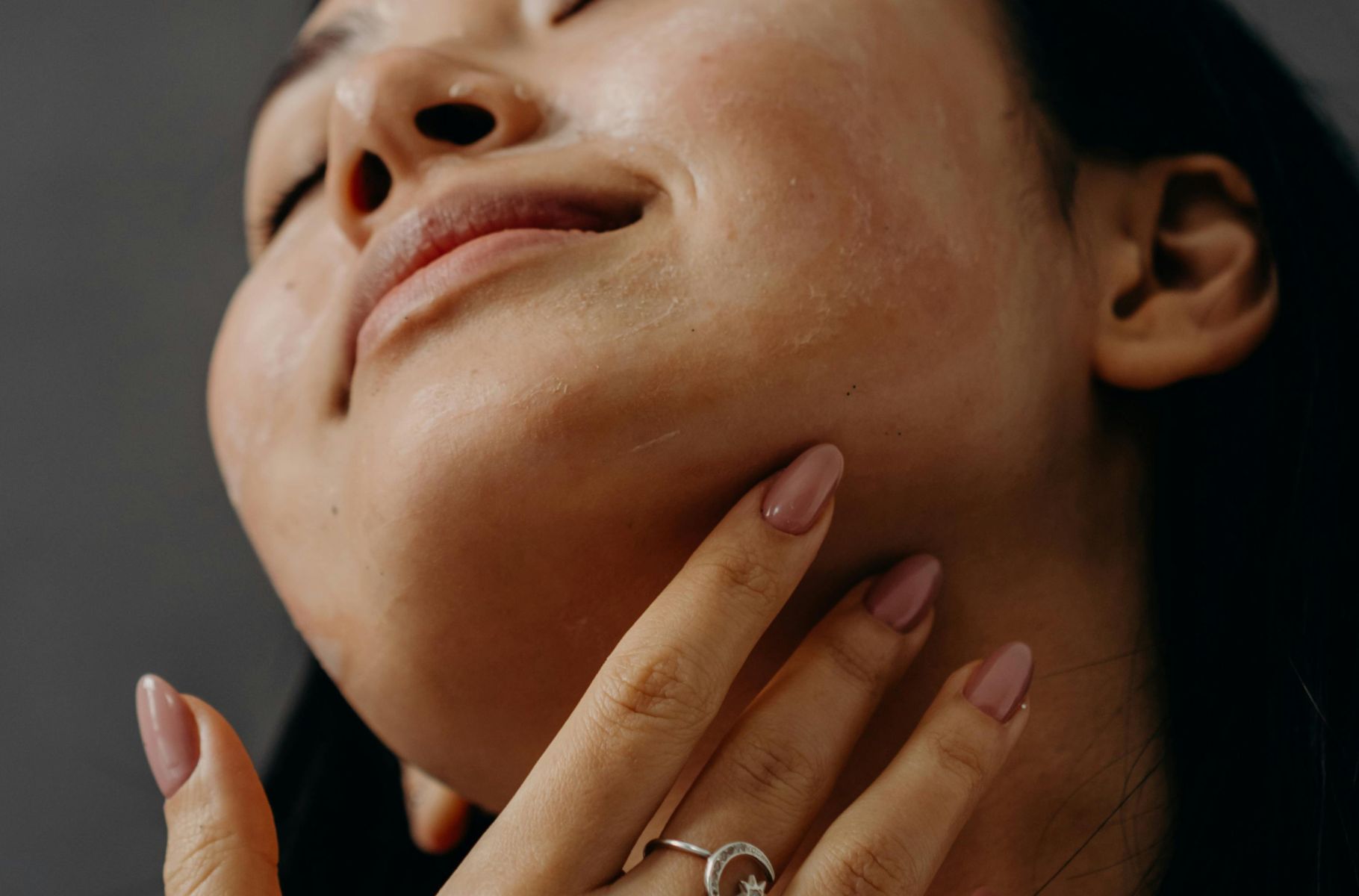 Is Face Fungus Ruining Your Skin? My Grazia Deep Dive on Fungal Acne